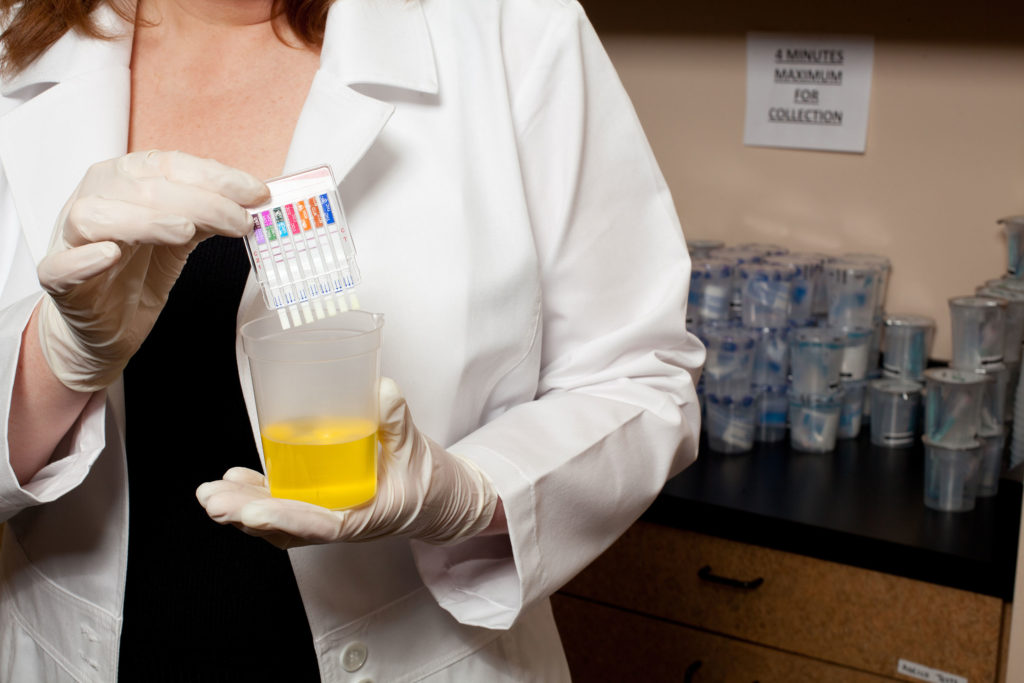 Woman holding urine test for THC testing